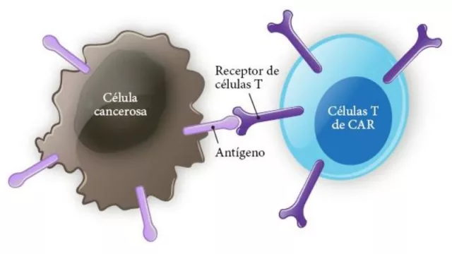 Experta reivindica la vigencia del trasplante de médula ósea frente a la terapia CAR-T